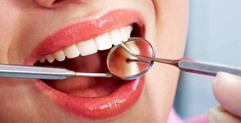 Implants dentaires en Turquie